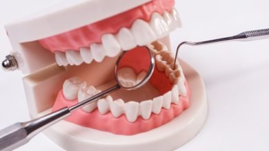 dental implants Surrey